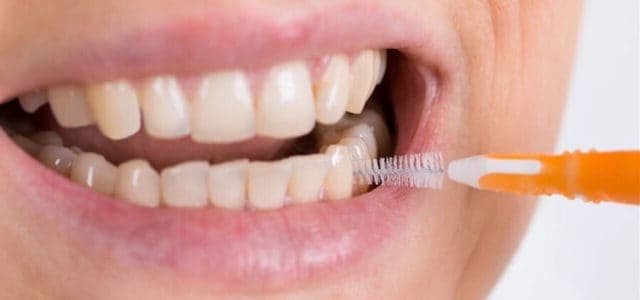 implantes carga inmediata 7